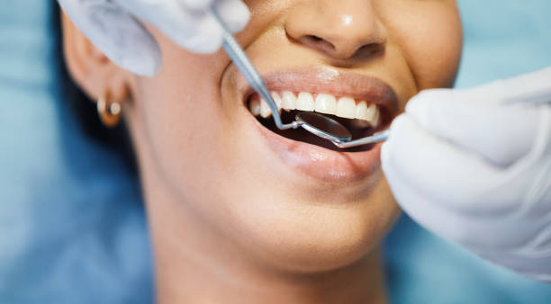 Best Emergency Tooth Extraction in Lyons, CO